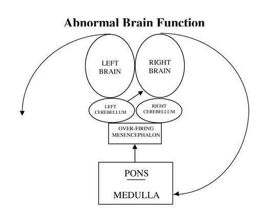 Abnormal Brain Function