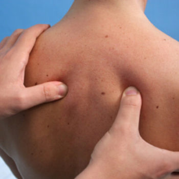 Acupressure in Lake Forest, CA